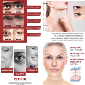 Retinol Collagen Face Moisturizer Cream Hyaluronic Acid, Day-Night Anti-Aging Moisturizer for Skin Tightening Lifting Firming Wrinkle Smoother for Women & Men (Cream)